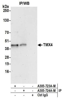 Detection of human TMX4 by WB of IP.