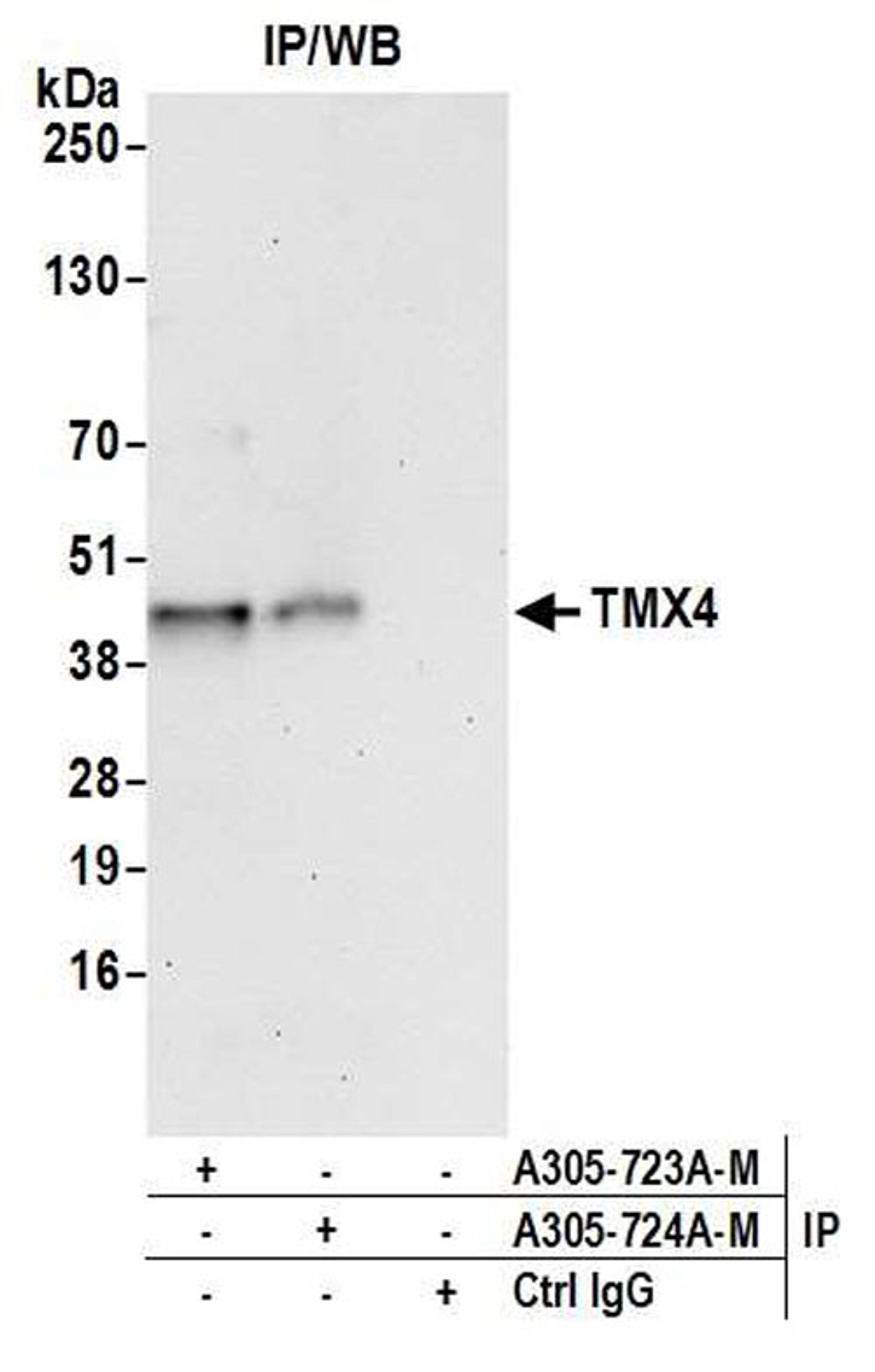 Detection of human TMX4 by WB of IP.