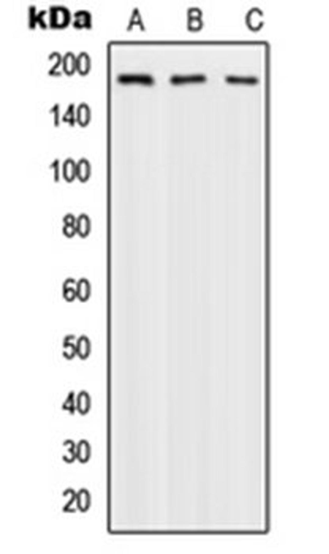 Western blot analysis of A549 (Lane 1), A431 (Lane 2), HeLa (Lane 3) whole cell lysates using POLA1 antibody