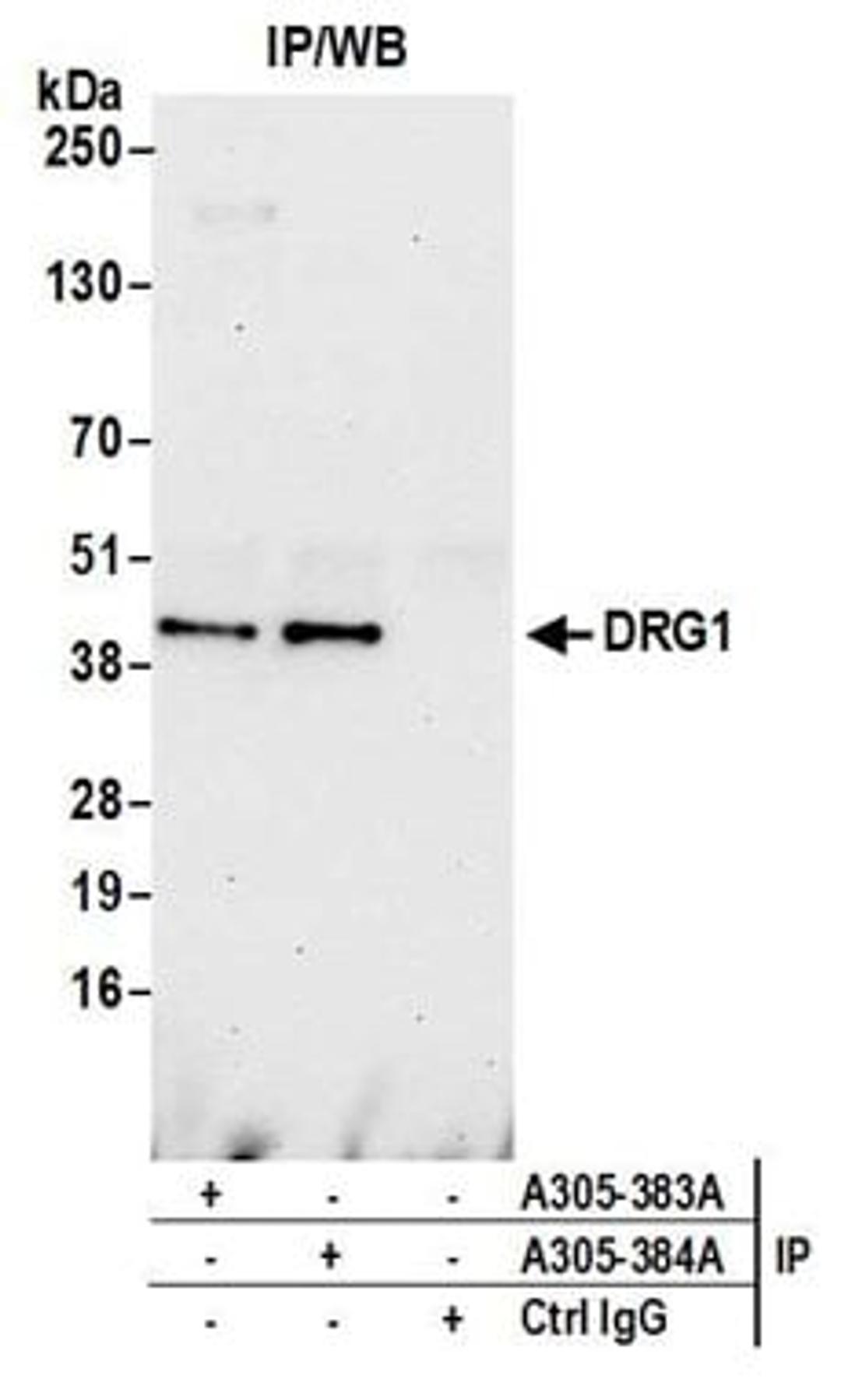 Detection of human DRG1 by western blot of immunoprecipitates.