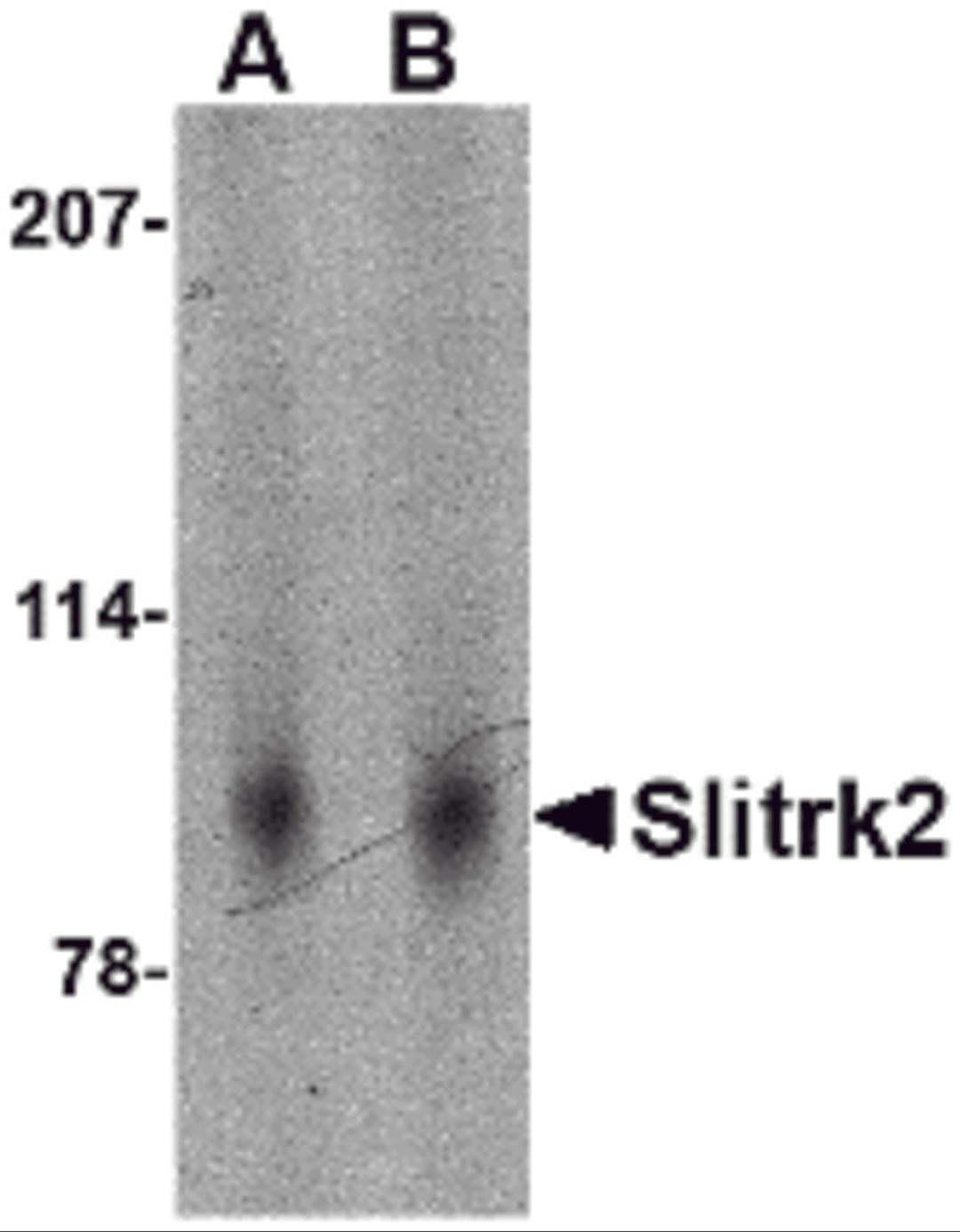 Western blot analysis of Slitrk2 in mouse brain tissue lysate with Slitrk2 antibody at (A) 1 and (B) 2 μg/mL.