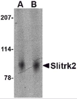 Western blot analysis of Slitrk2 in mouse brain tissue lysate with Slitrk2 antibody at (A) 1 and (B) 2 μg/mL.