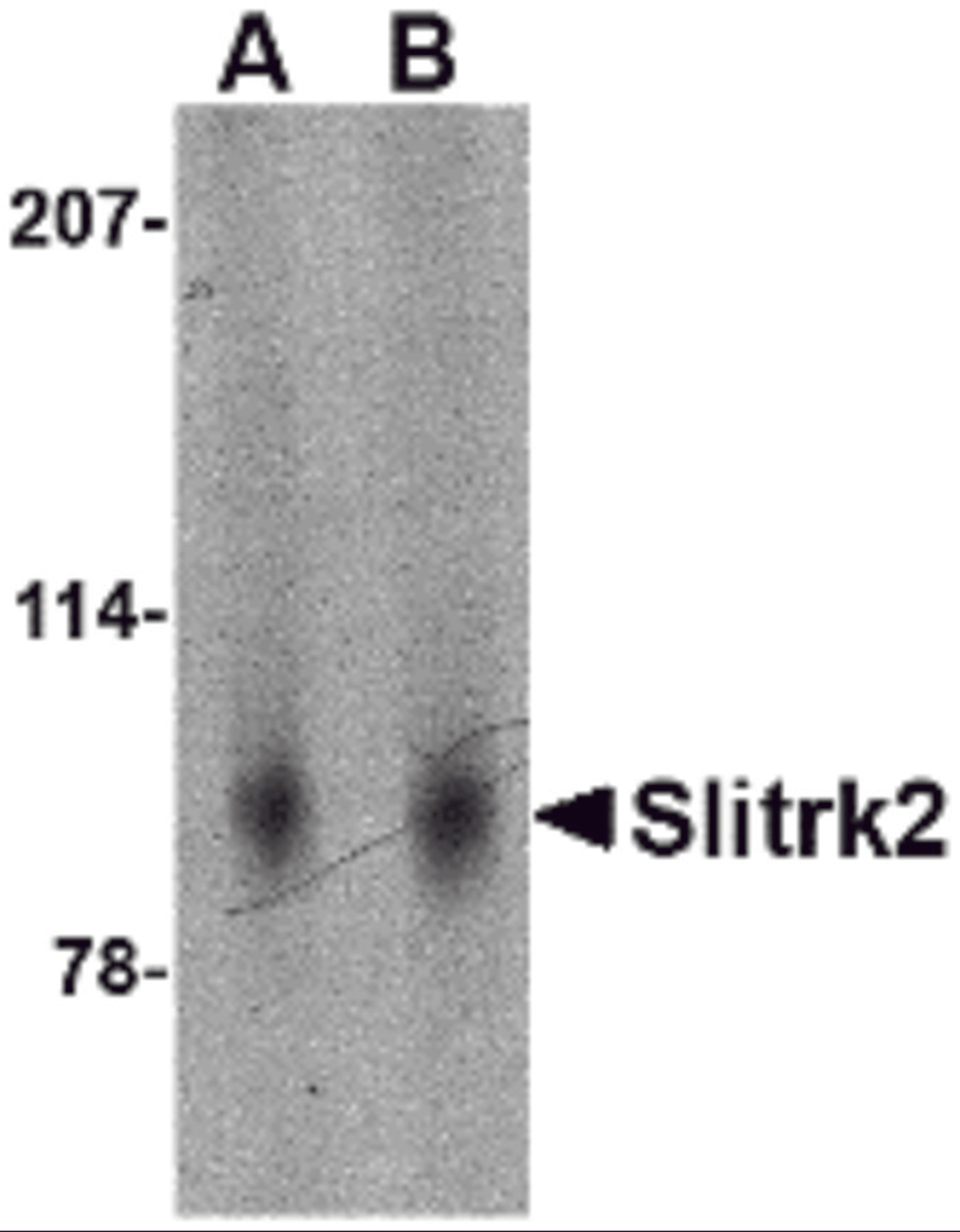 Western blot analysis of Slitrk2 in mouse brain tissue lysate with Slitrk2 antibody at (A) 1 and (B) 2 μg/mL.