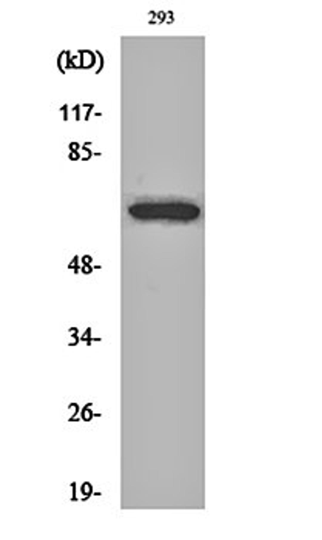 Western blot analysis of 293 cell lysates using ARA70 antibody