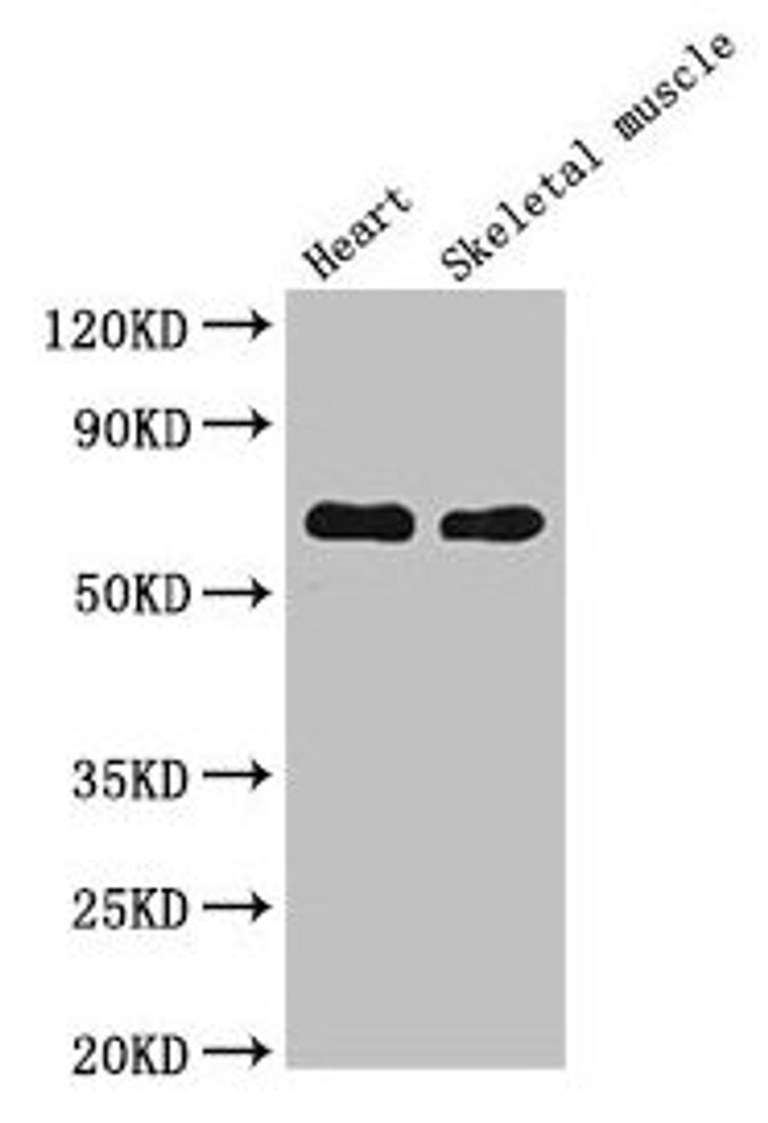 Western Blot. Positive WB detected in: Mouse heart tissue, Mouse skeletal muscle tissue. All lanes: CES1 antibody at 5µg/ml. Secondary. Goat polyclonal to rabbit IgG at 1/50000 dilution. Predicted band size: 63 kDa. Observed band size: 63 kDa