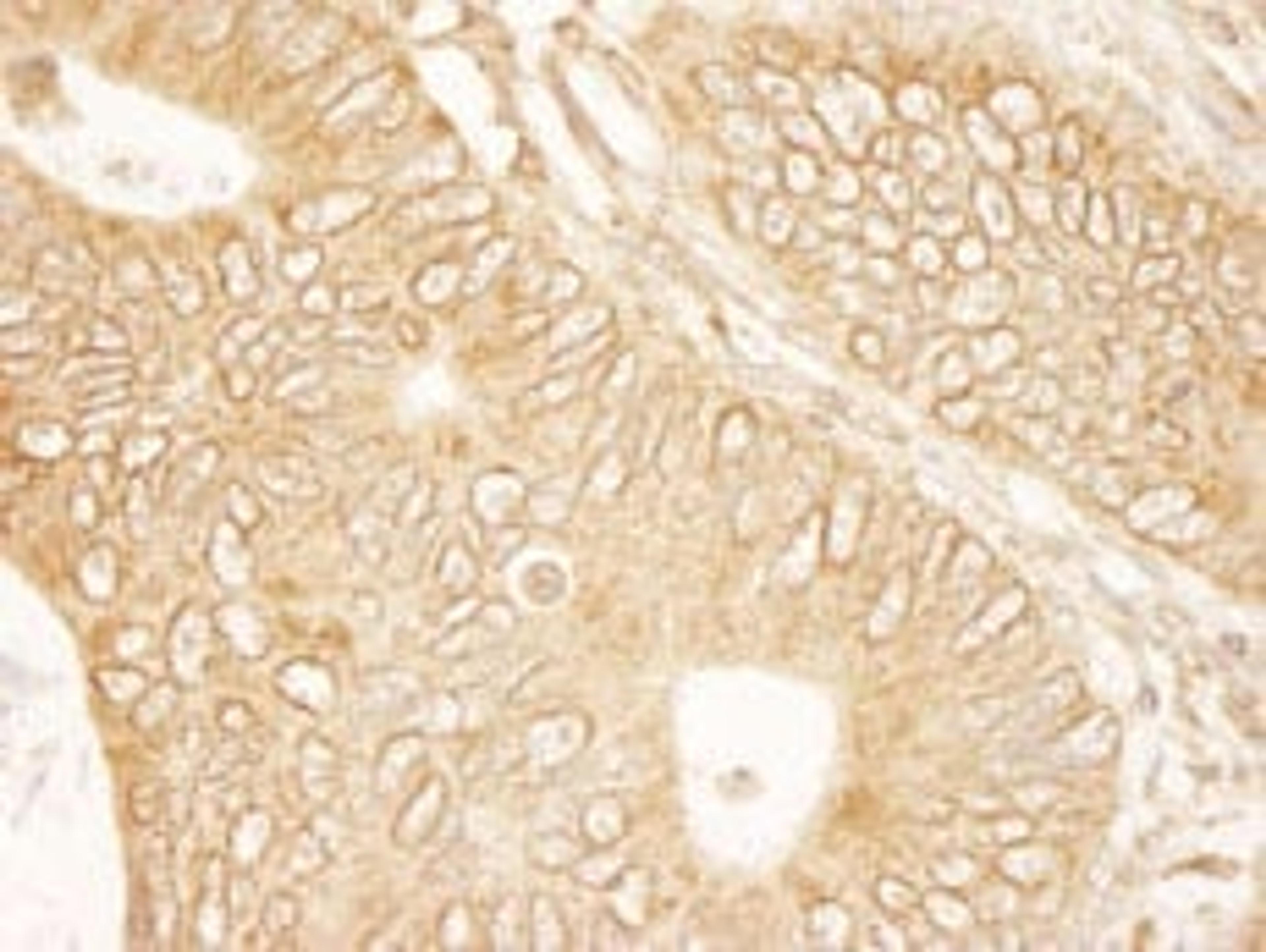 Detection of human RanGAP1 by immunohistochemistry.