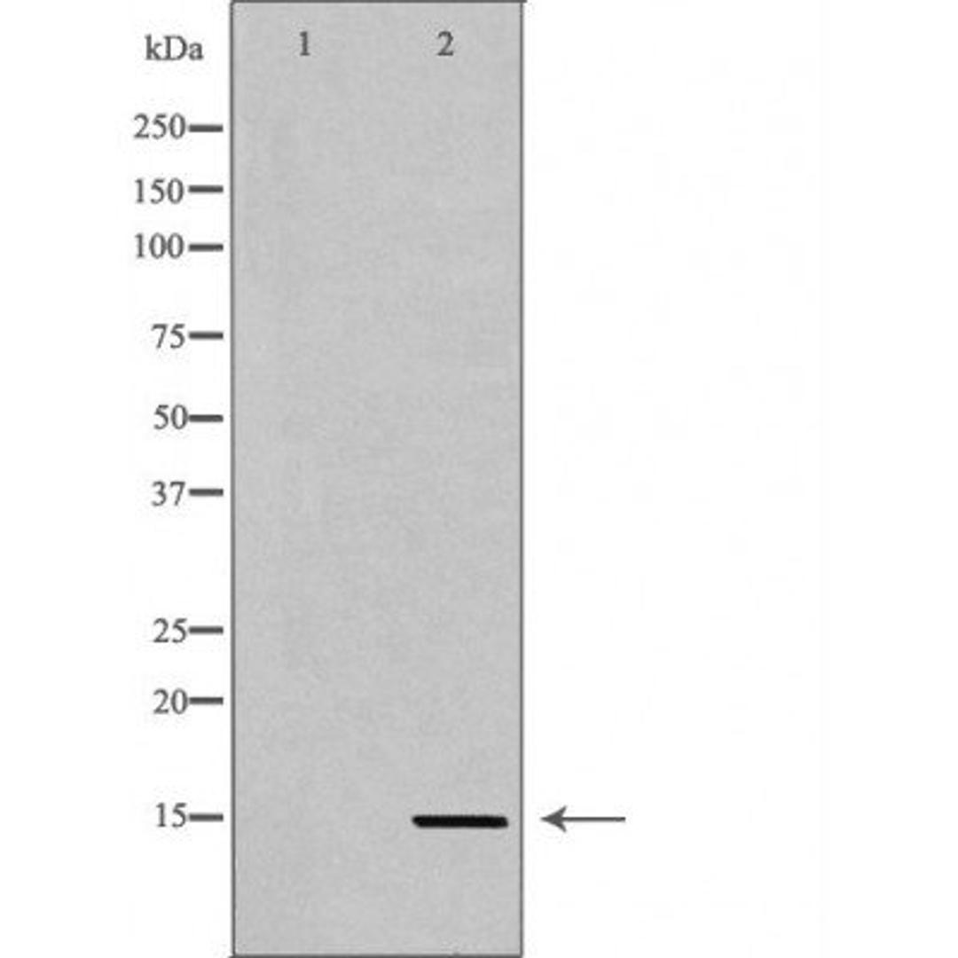 Western blot analysis of HeLa cell line and H3 protein expressed in E.coli using Histone H3K36me3 antibody