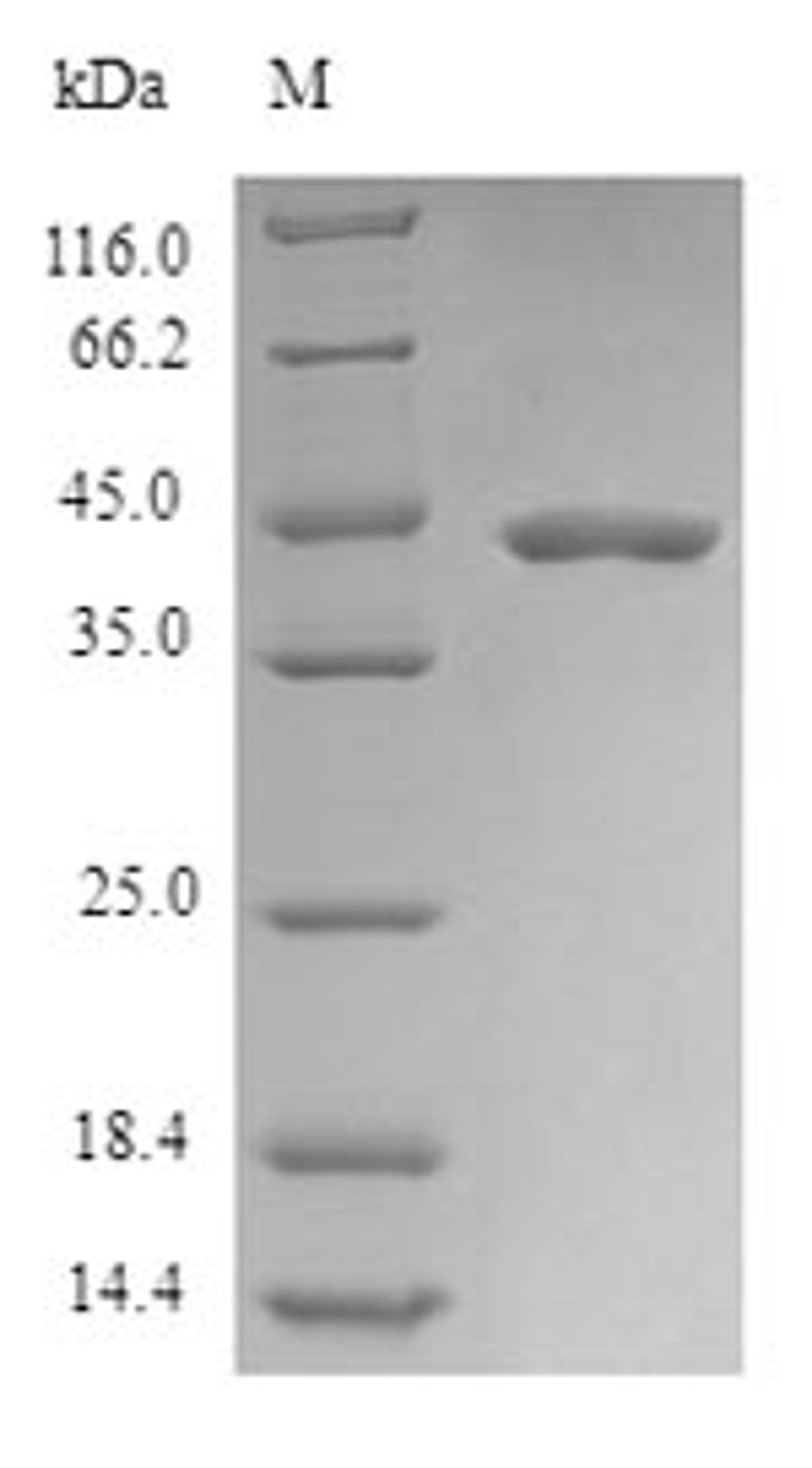 (Tris-Glycine gel) Discontinuous SDS-PAGE (reduced) with 5% enrichment gel and 15% separation gel.