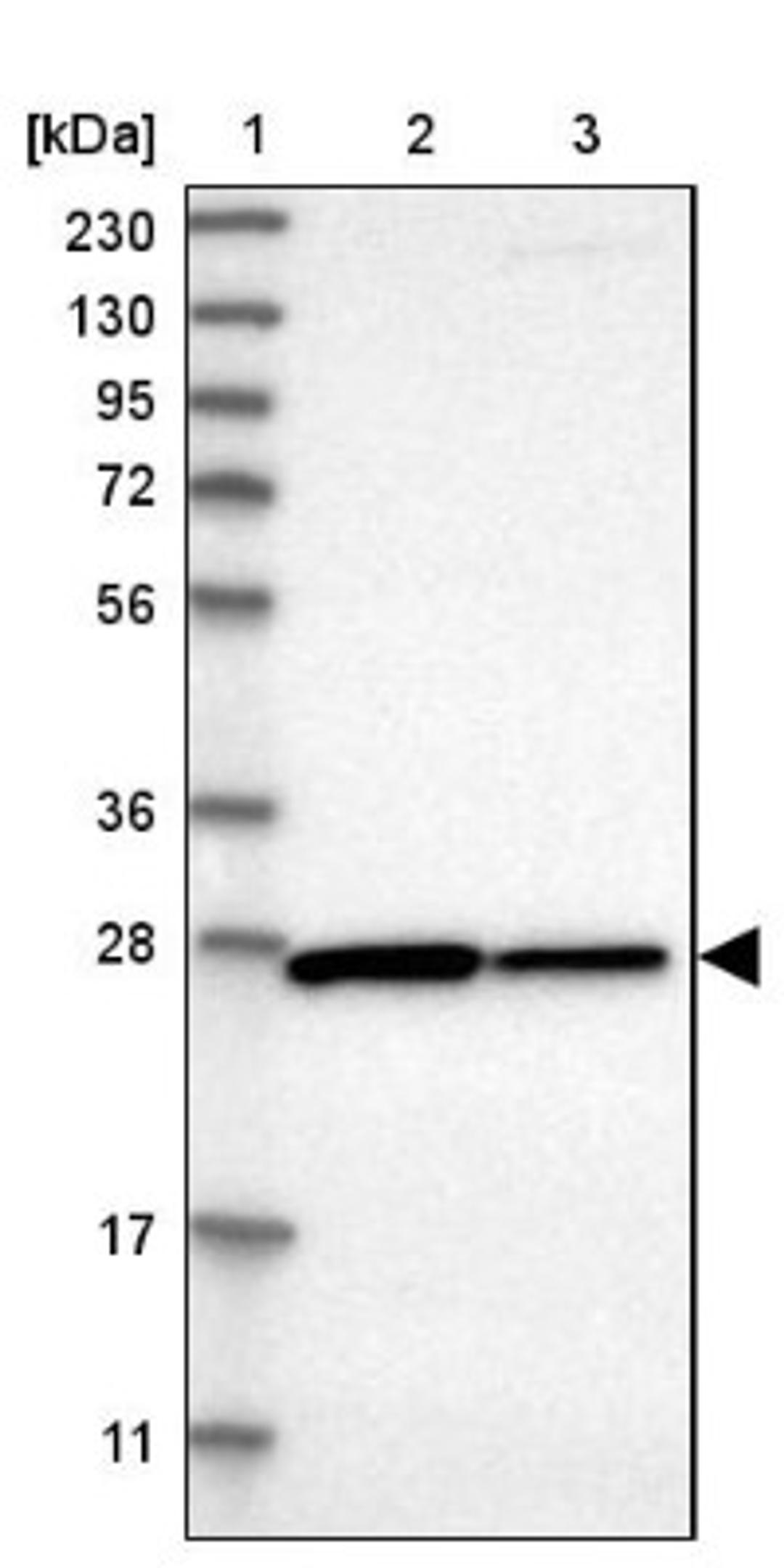 Western Blot: CYB5D1 Antibody [NBP1-83529] - Lane 1: Marker [kDa] 230, 130, 95, 72, 56, 36, 28, 17, 11<br/>Lane 2: Human cell line RT-4<br/>Lane 3: Human cell line U-251MG sp