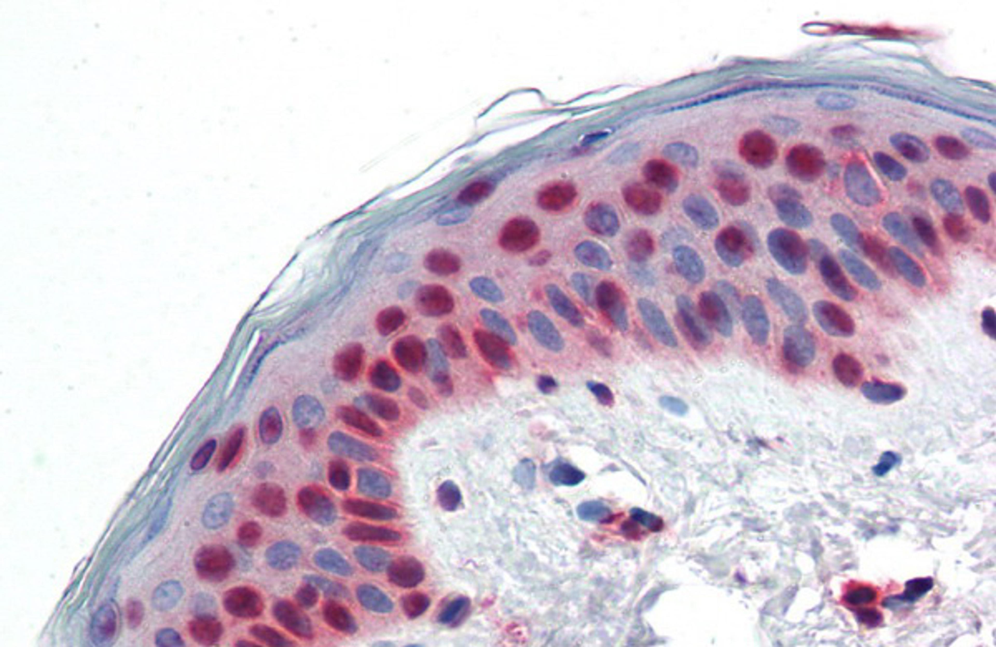 Antibody used in IHC on Human Skin at 5.0 ug/ml.