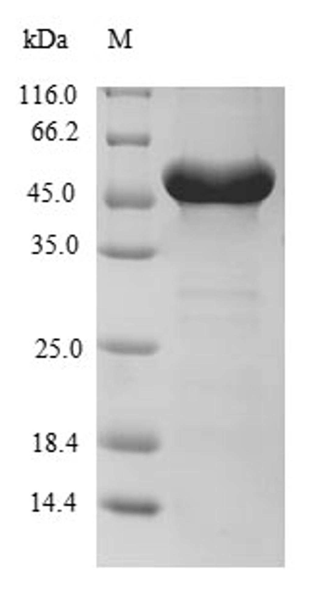 (Tris-Glycine gel) Discontinuous SDS-PAGE (reduced) with 5% enrichment gel and 15% separation gel.