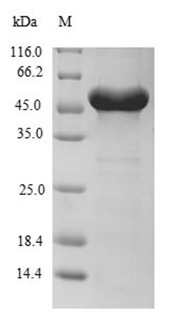 (Tris-Glycine gel) Discontinuous SDS-PAGE (reduced) with 5% enrichment gel and 15% separation gel.