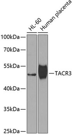 Western blot - TACR3 antibody (A7220)