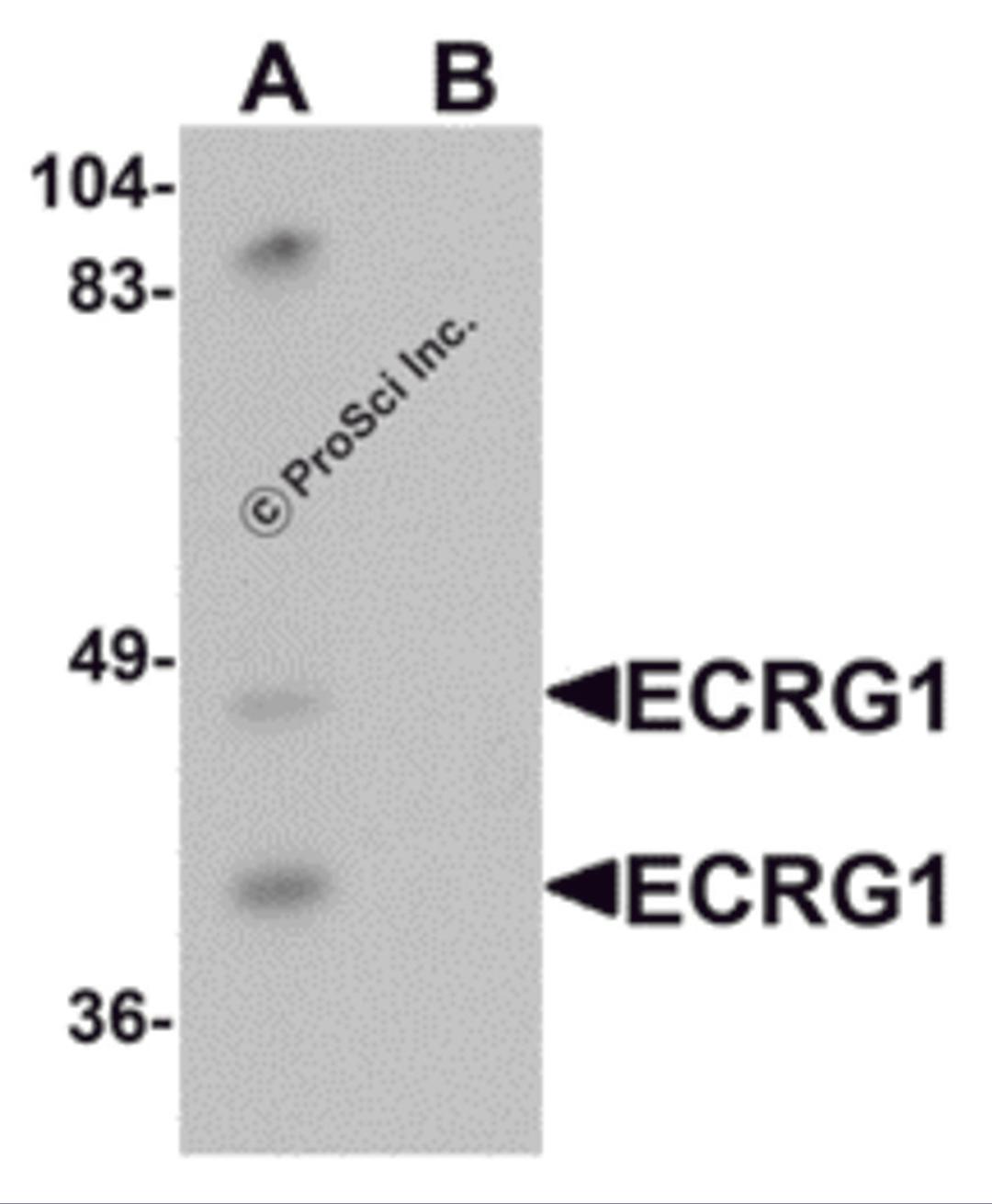 Western blot analysis of ECRG1 in mouse liver tissue lysate with ECRG1 antibody at 1 &#956;g/mL in (A) the absence and (B) the presence of blocking peptide.