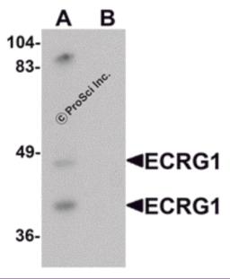 Western blot analysis of ECRG1 in mouse liver tissue lysate with ECRG1 antibody at 1 &#956;g/mL in (A) the absence and (B) the presence of blocking peptide.