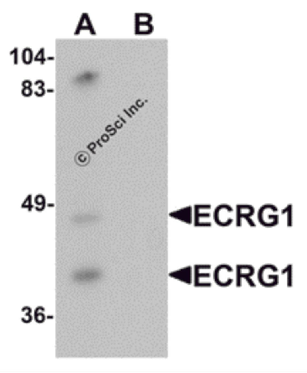 Western blot analysis of ECRG1 in mouse liver tissue lysate with ECRG1 antibody at 1 μg/mL in (A) the absence and (B) the presence of blocking peptide.