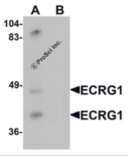Western blot analysis of ECRG1 in mouse liver tissue lysate with ECRG1 antibody at 1 μg/mL in (A) the absence and (B) the presence of blocking peptide.