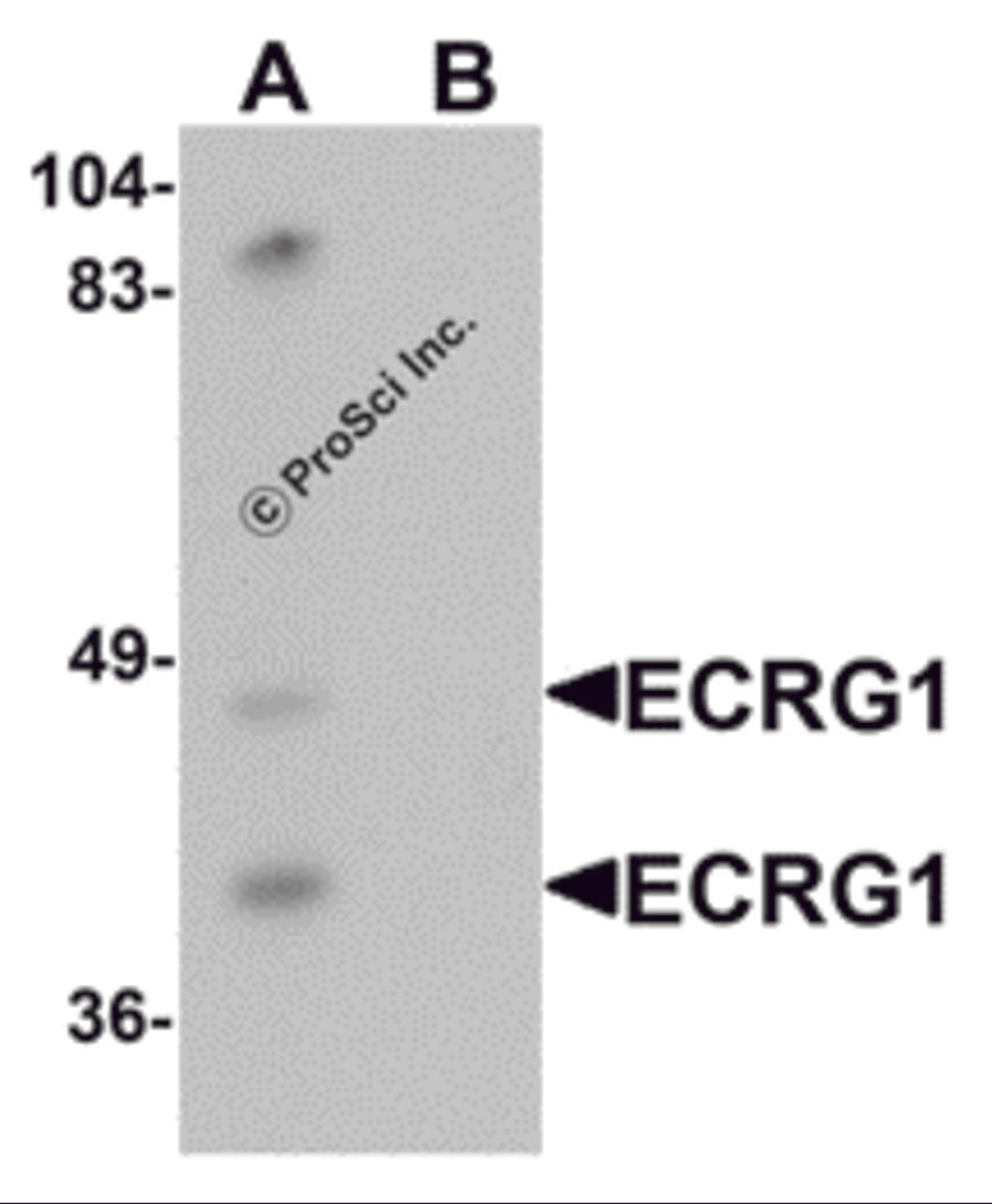 Western blot analysis of ECRG1 in mouse liver tissue lysate with ECRG1 antibody at 1 μg/mL in (A) the absence and (B) the presence of blocking peptide.