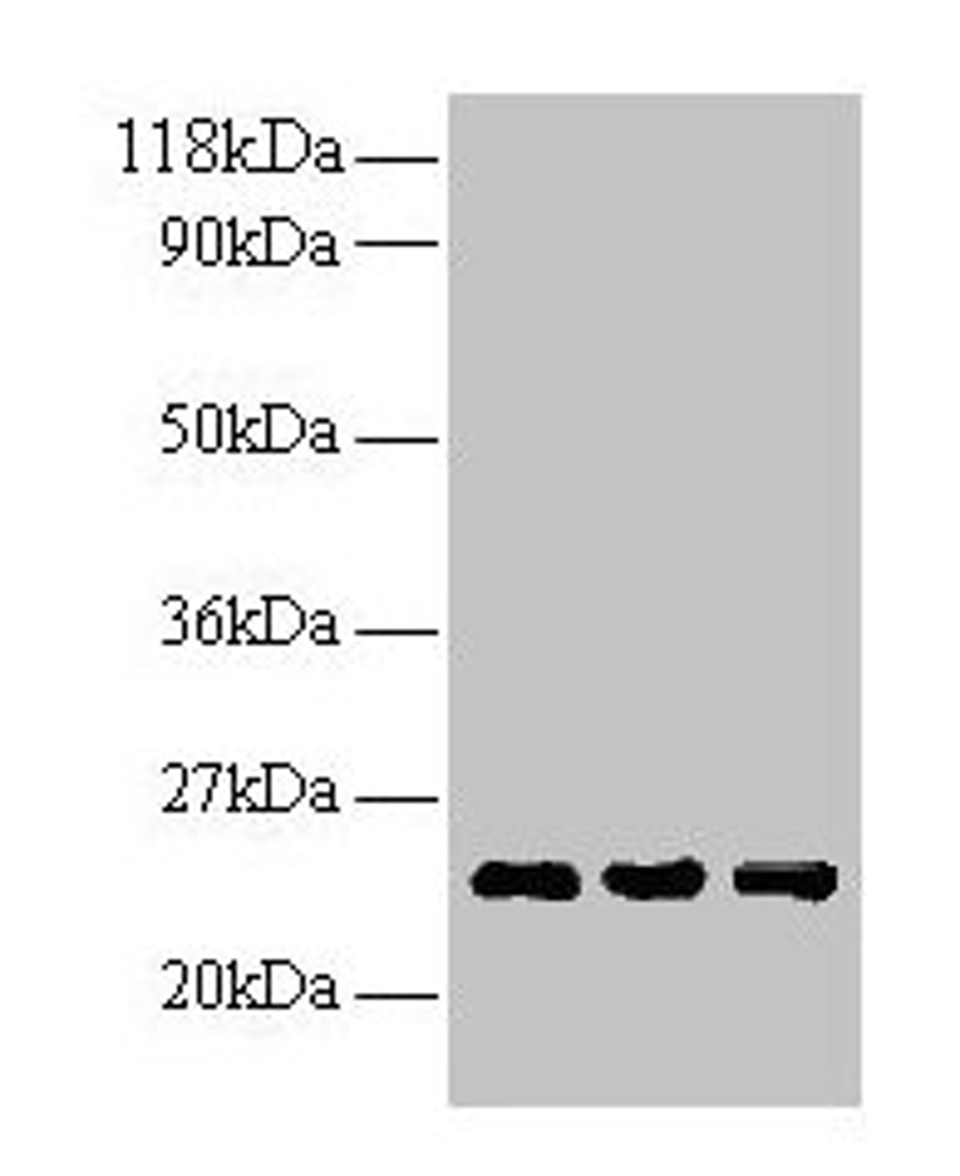 Western blot. All lanes: LCN2 antibody at 2µg/ml. Lane 1: Human positive serum at 1: 10. Lane 2: Human positive serum at 1: 100. Lane 3: Human positive serum at 1: 500. Secondary. Goat polyclonal to rabbit IgG at 1/15000 dilution. Predicted band size: 23 kDa. Observed band size: 23 kDa