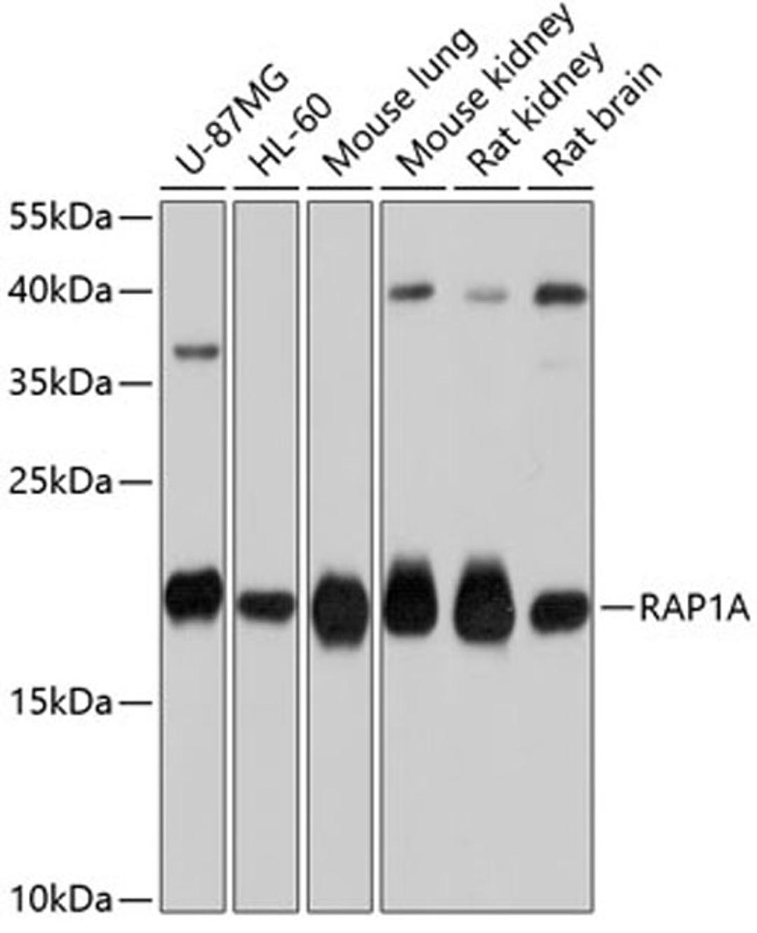 Western blot - RAP1A antibody (A0975)