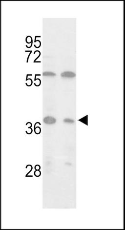 Western blot analysis of Isocitrate dehydrogenase in MCF-7, Jurkat cell line lysates (35ug/lane).