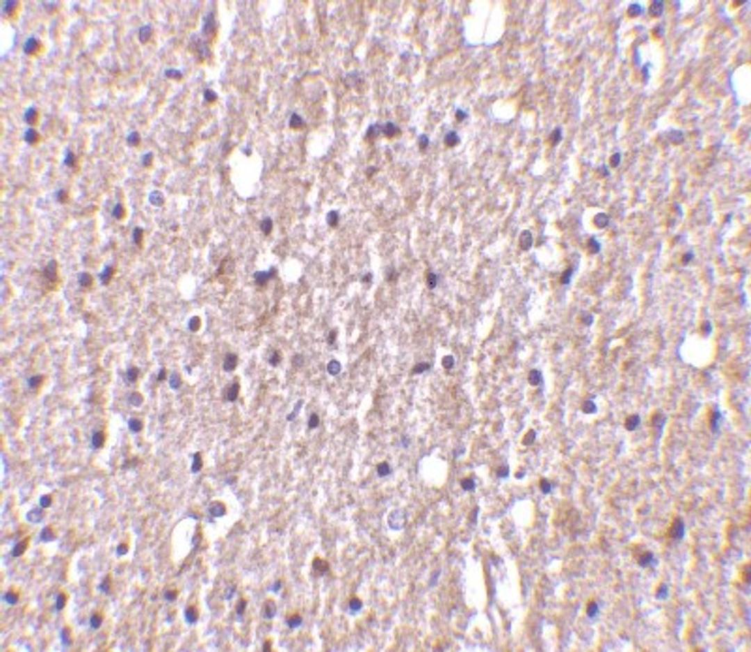 Immunohistochemistry-Paraffin: TWEAK/TNFSF12 Antibody [NBP1-76695] - Human brain tissue with TWEAK antibody at 10 ug/ml.