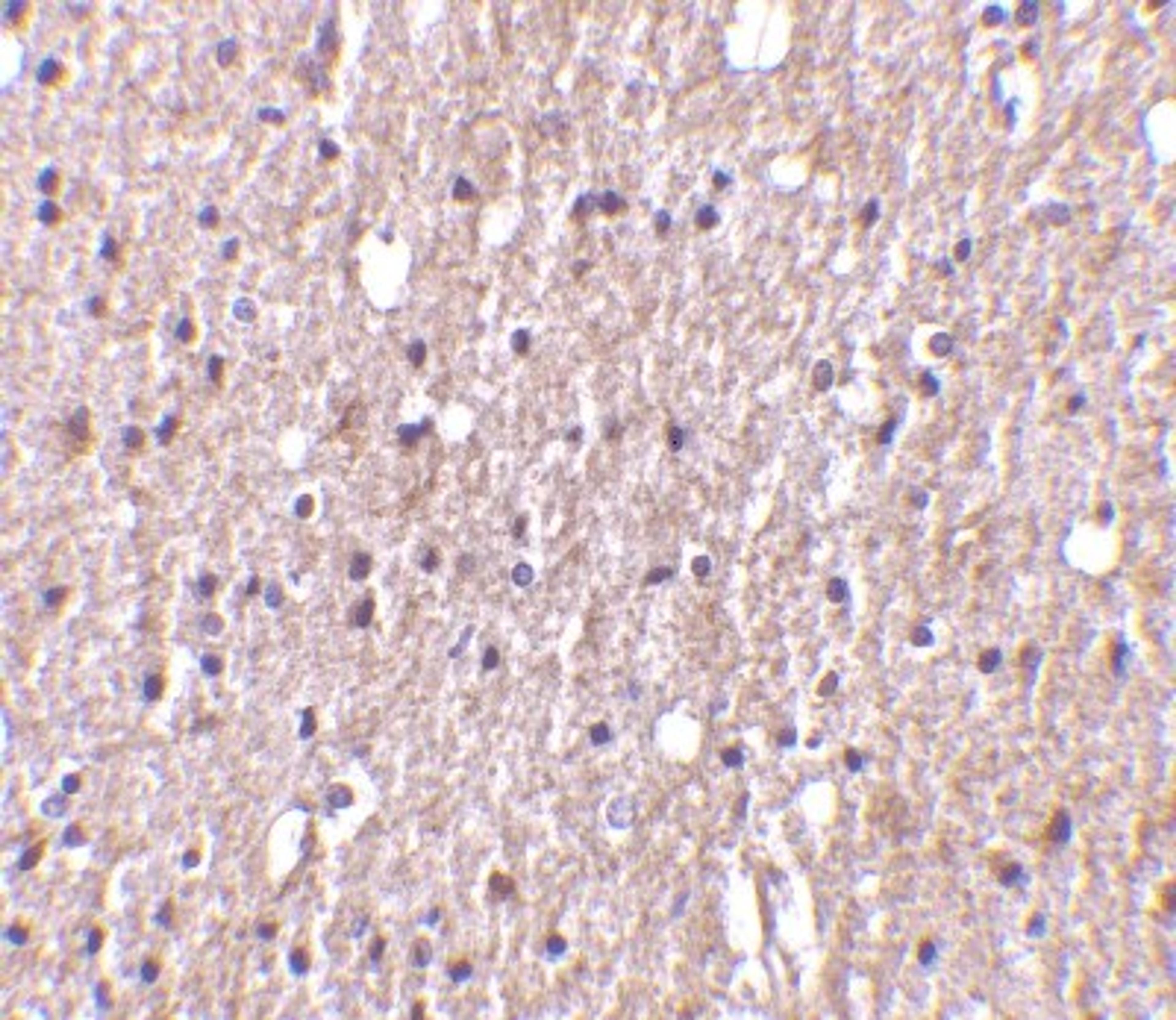 Immunohistochemistry-Paraffin: TWEAK/TNFSF12 Antibody [NBP1-76695] - Human brain tissue with TWEAK antibody at 10 ug/ml.