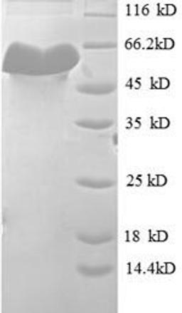 (Tris-Glycine gel) Discontinuous SDS-PAGE (reduced) with 5% enrichment gel and 15% separation gel.