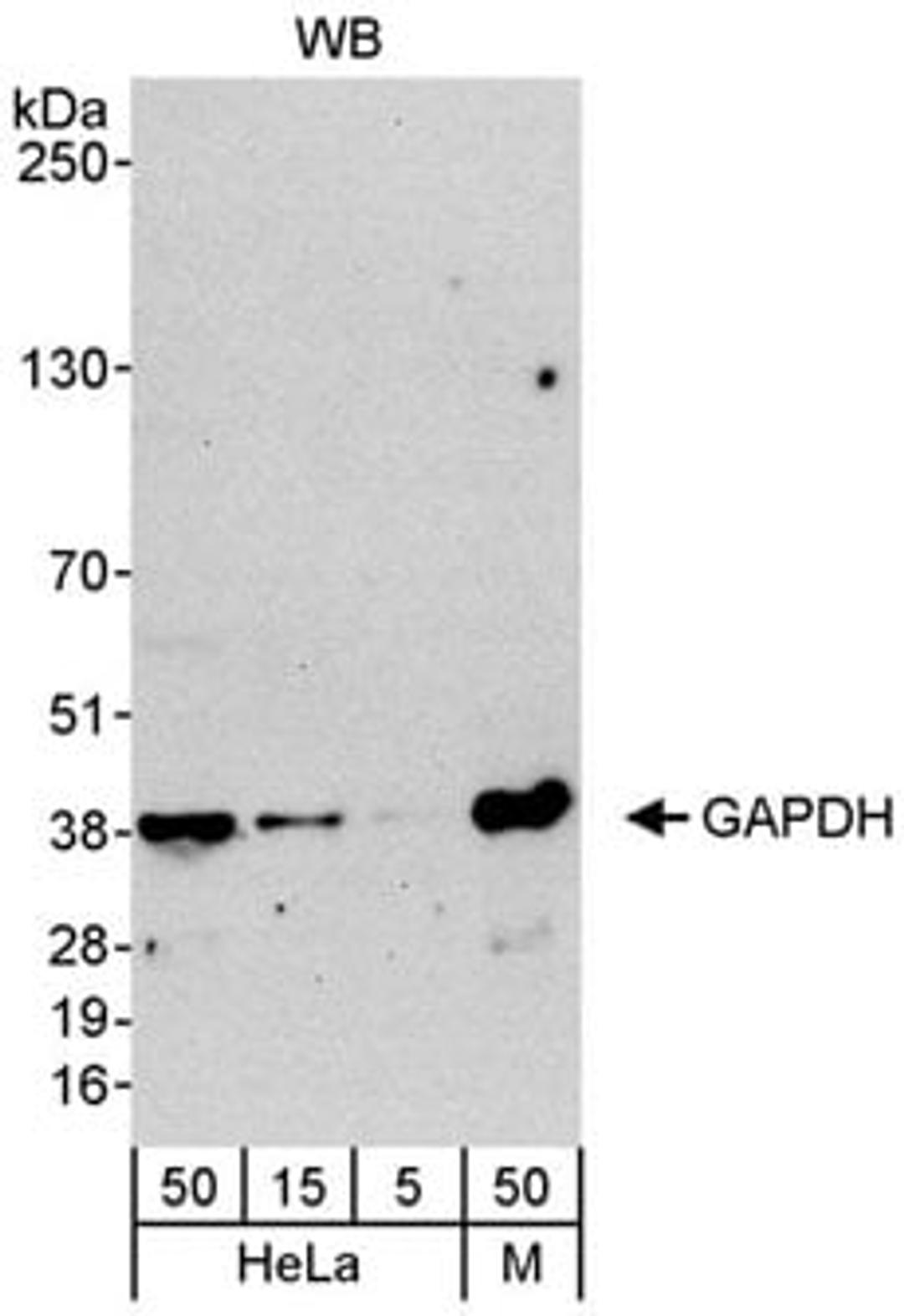 Detection of human and mouse GAPDH by western blot.