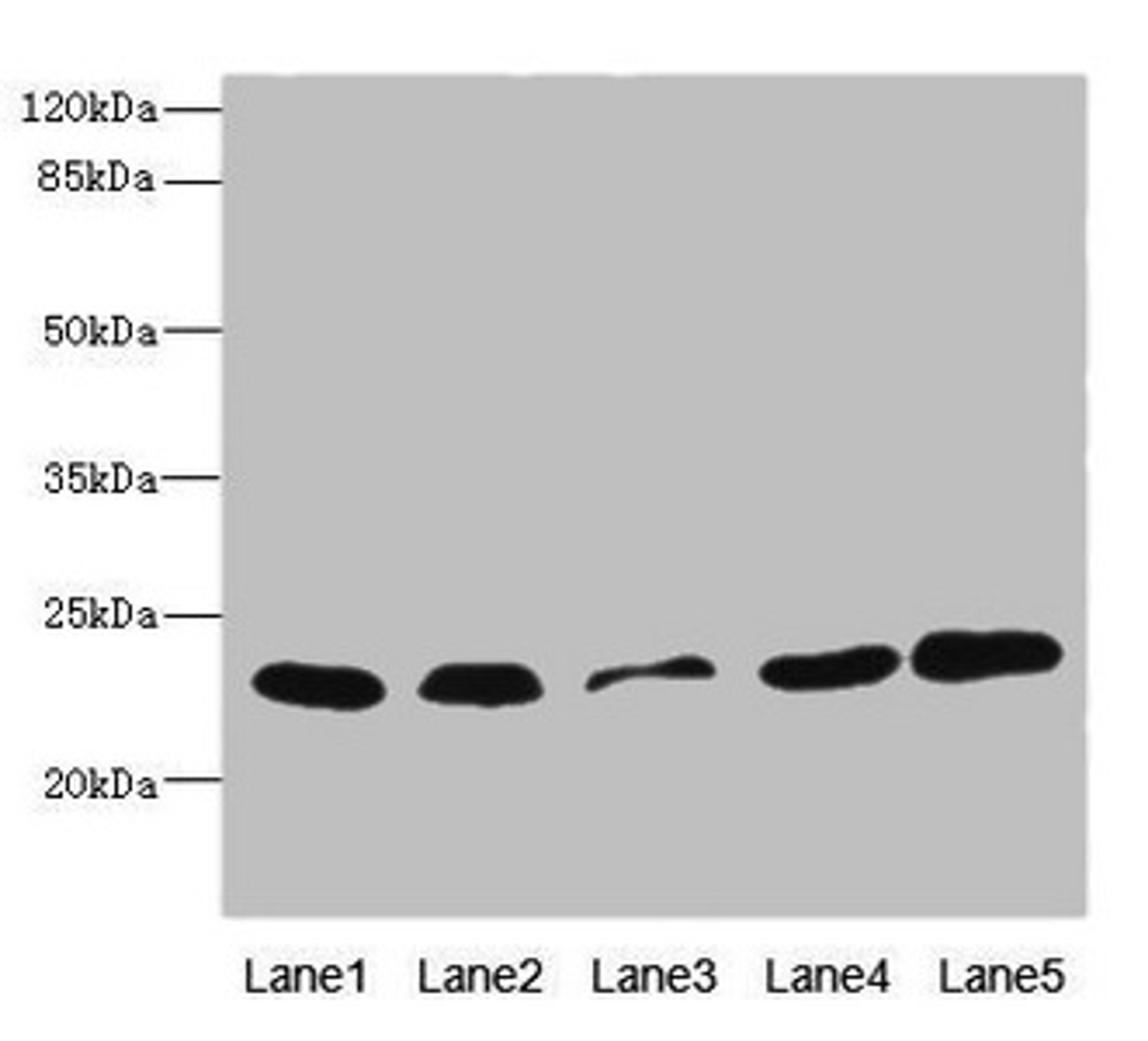Western blot. All lanes: TIMM23 antibody at 3.03µg/ml. Lane 1: Rat heart tissue. Lane 2: Mouse liver tissue. Lane 3: A431 whole cell lysate. Lane 4: MCF-7 whole cell lysate. Lane 5: Jurkat whole cell lysate. Secondary. Goat polyclonal to rabbit IgG at 1/10000 dilution. Predicted band size: 22 kDa. Observed band size: 22 kDa