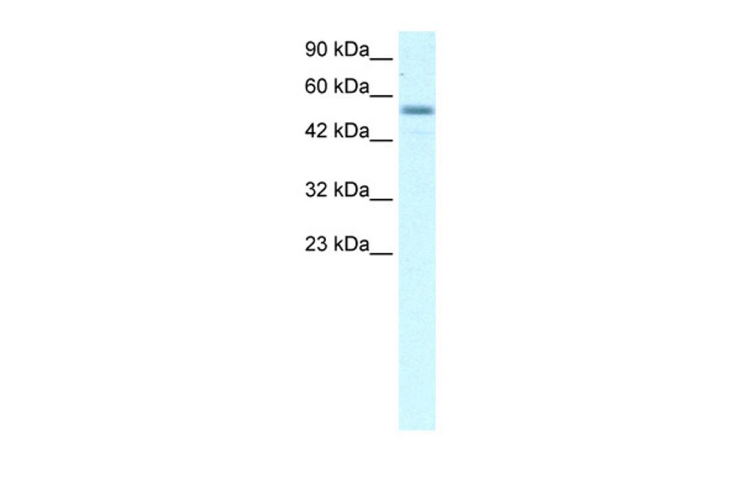 Antibody used in WB on Human Raji at 2.5 ug/ml.