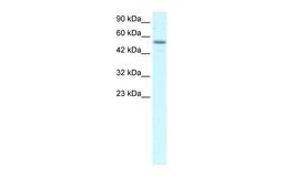 Antibody used in WB on Human Raji at 2.5 ug/ml.