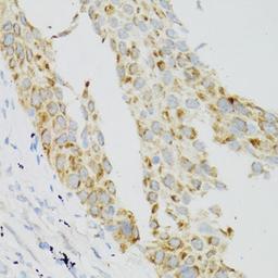Immunohistochemistry - TEK antibody (A0743)