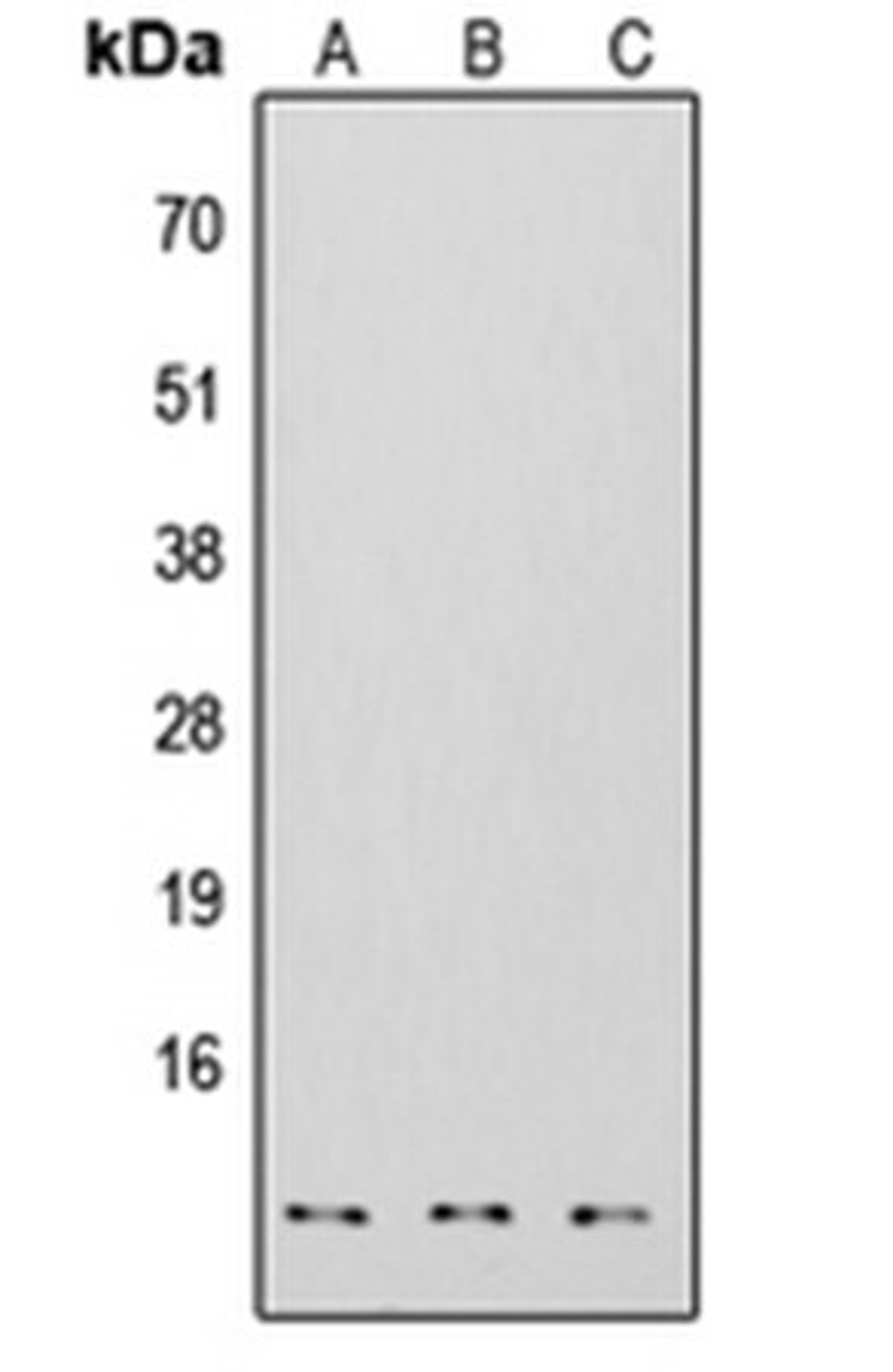 Western blot analysis of HEK293T (Lane 1), NS-1 (Lane 2), H9C2 (Lane 3) whole cell lysates using S100-A7 antibody