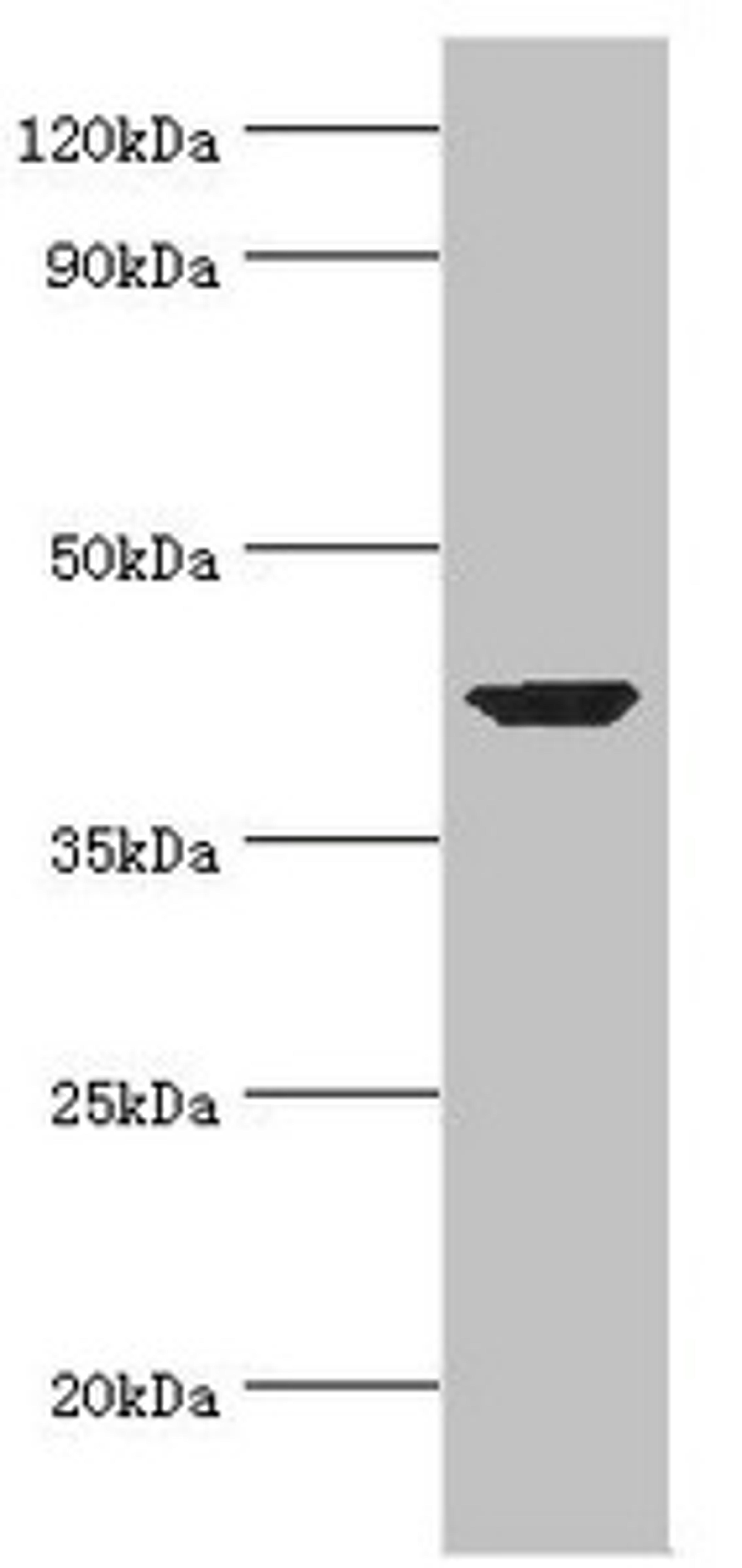 Western blot. All lanes: Alpha-centractin antibody at 7ug/ml + Mouse brain tissue. Secondary. Goat polyclonal to rabbit IgG at 1/10000 dilution. Predicted band size: 43 kDa. Observed band size: 43 kDa.