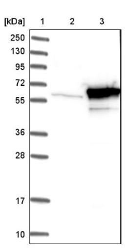 Western Blot: TBCE Antibody [NBP1-81711] - Lane 1: Marker [kDa] 250, 130, 95, 72, 55, 36, 28, 17, 10<br/>Lane 2: Negative control (vector only transfected HEK293T lysate)<br/>Lane 3: Over-expression lysate (Co-expressed with a C-terminal myc-DDK tag (~3.1 kDa) in mammalian HEK293T cells, LY418845)