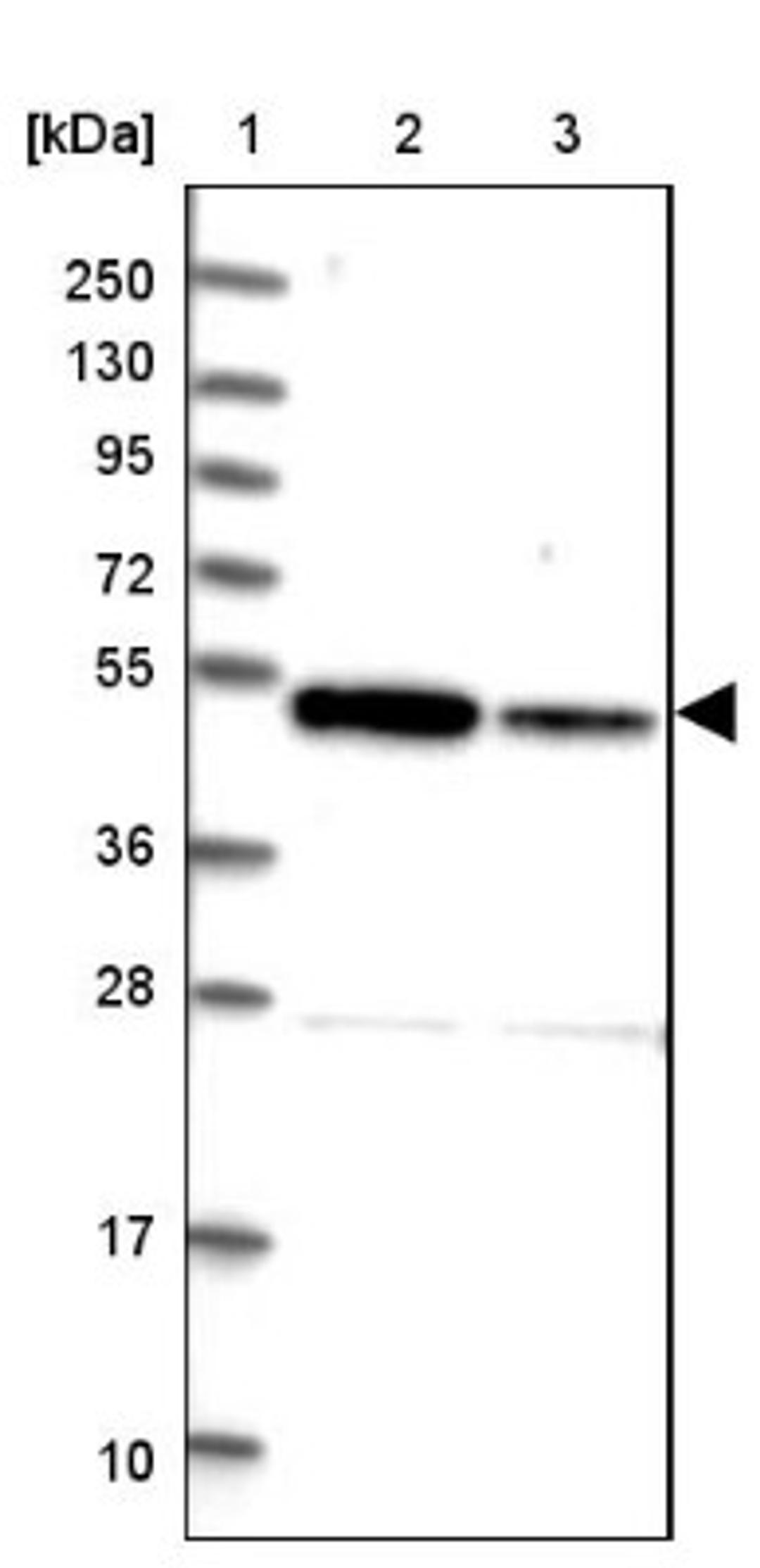 Western Blot: ZNF662 Antibody [NBP2-32632] - Lane 1: Marker [kDa] 250, 130, 95, 72, 55, 36, 28, 17, 10<br/>Lane 2: Human cell line RT-4<br/>Lane 3: Human cell line U-251MG sp