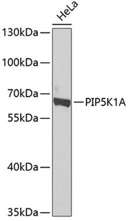 Western blot - PIP5K1A antibody (A7941)