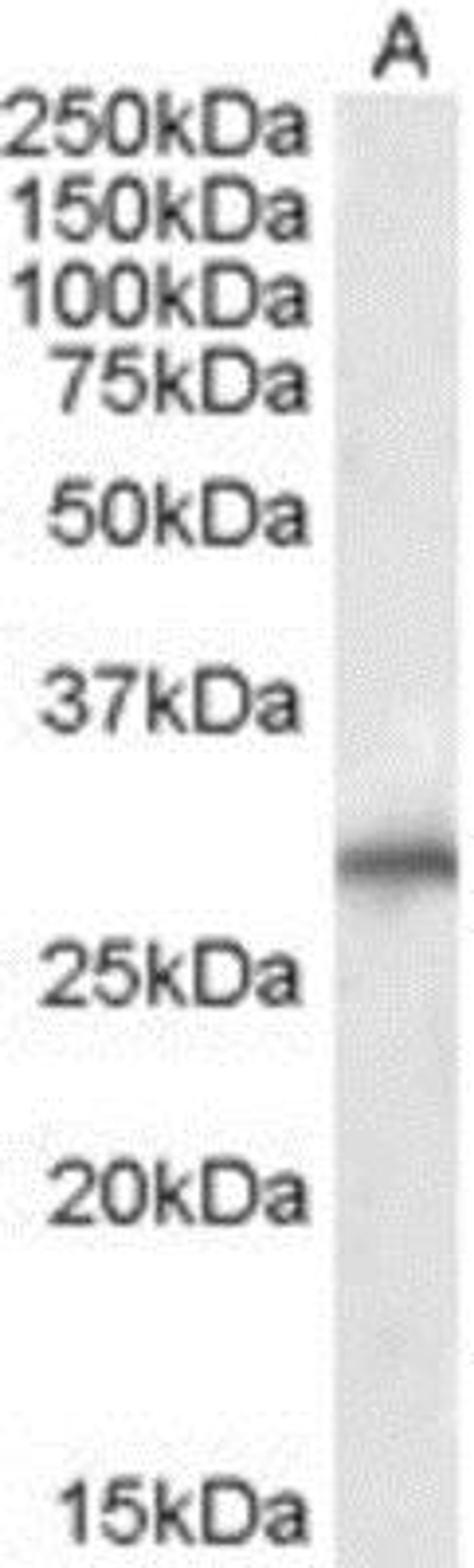 Western Blot: SIAH1 Antibody [NB300-974] - Analysis of Human Liver lysate (RIPA buffer, 35ug total protein per lane).