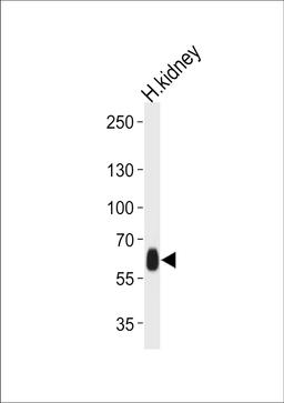 Western blot analysis of lysate from human kidney tissue lysate, using DFNB31 Antibody at 1:1000 at each lane.