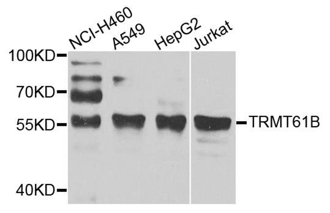 Western blot analysis of extracts of various cell lines using TRMT61B antibody