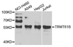 Western blot analysis of extracts of various cell lines using TRMT61B antibody