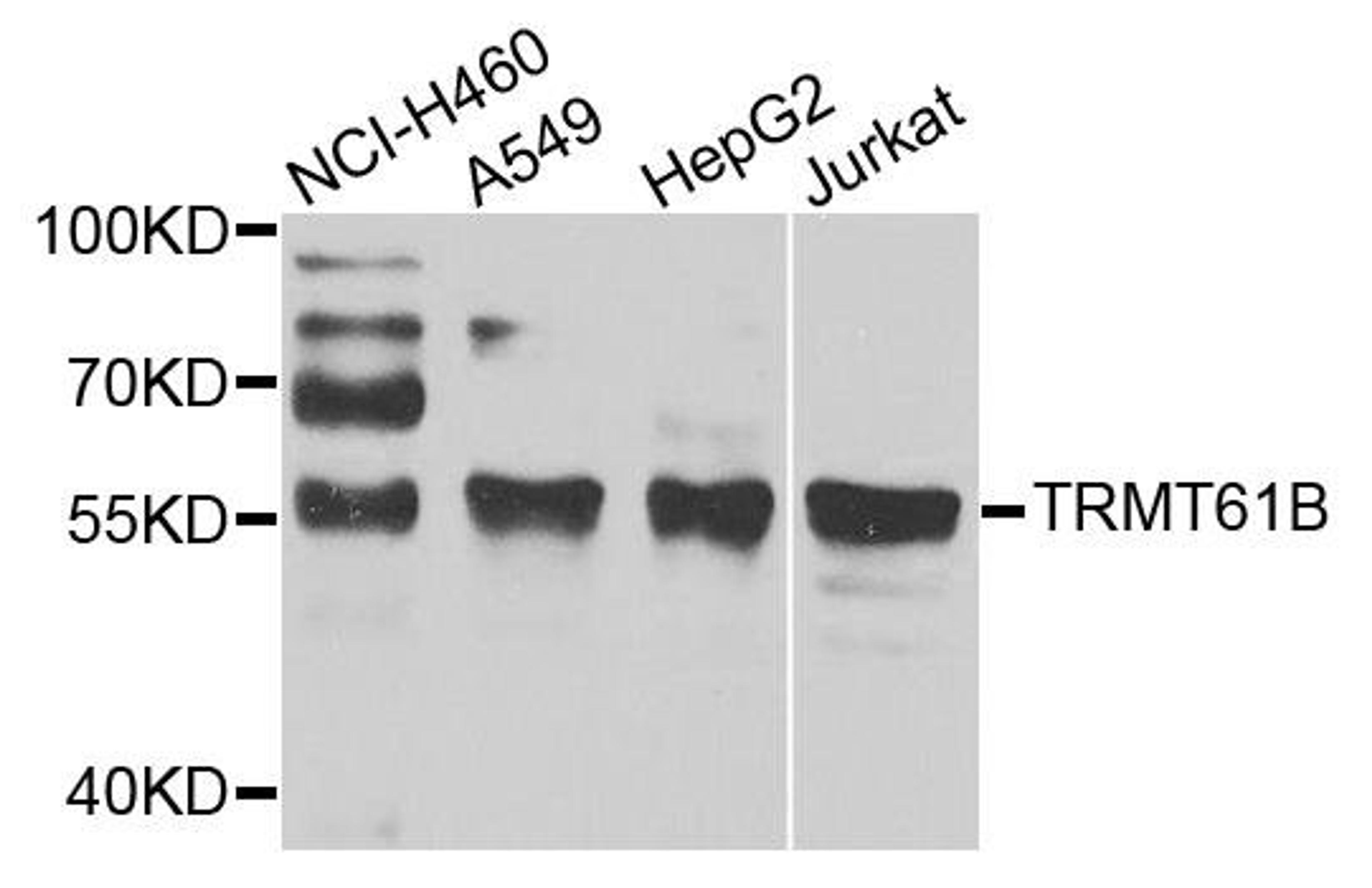 Western blot analysis of extracts of various cell lines using TRMT61B antibody