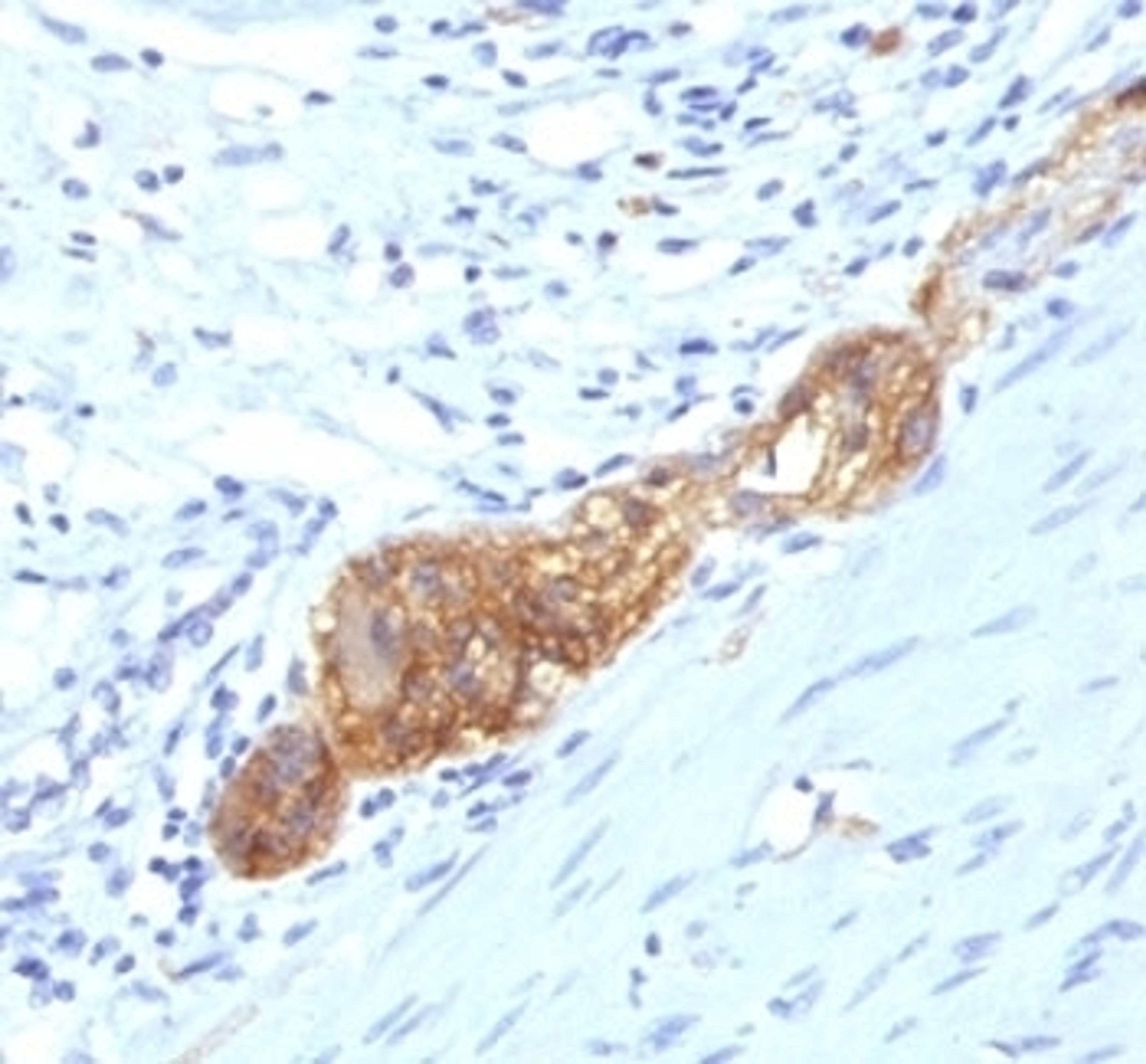 Formalin-fixed, paraffin-embedded human colon stained with anti-CD56 antibody (SPM489)