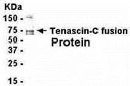 E coli-derived fusion protein as test antigen. Affinity-purified IgY dilution: 1:2000, Goat anti-IgY-HRP dilution: 1:1000. Colorimetric method for signal development.