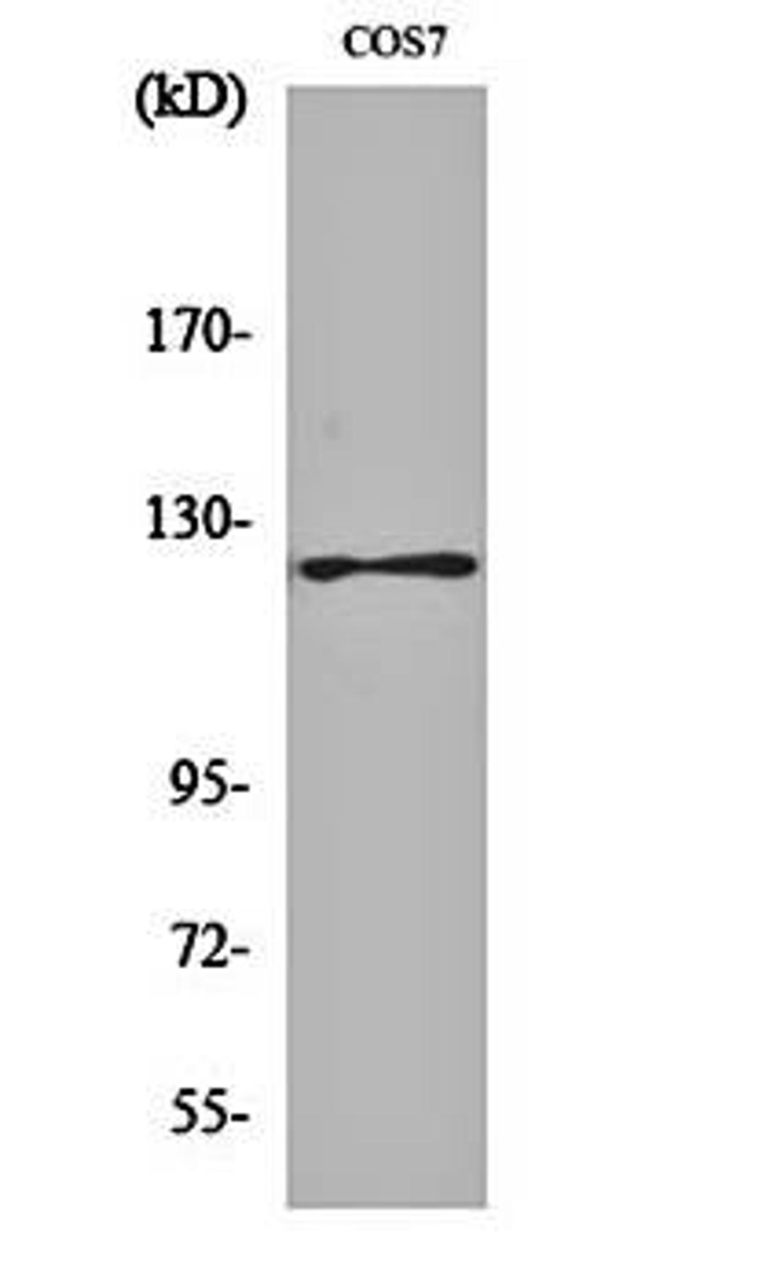 Western blot analysis of COS7 cell lysates using FAK (phospho-Y861) antibody