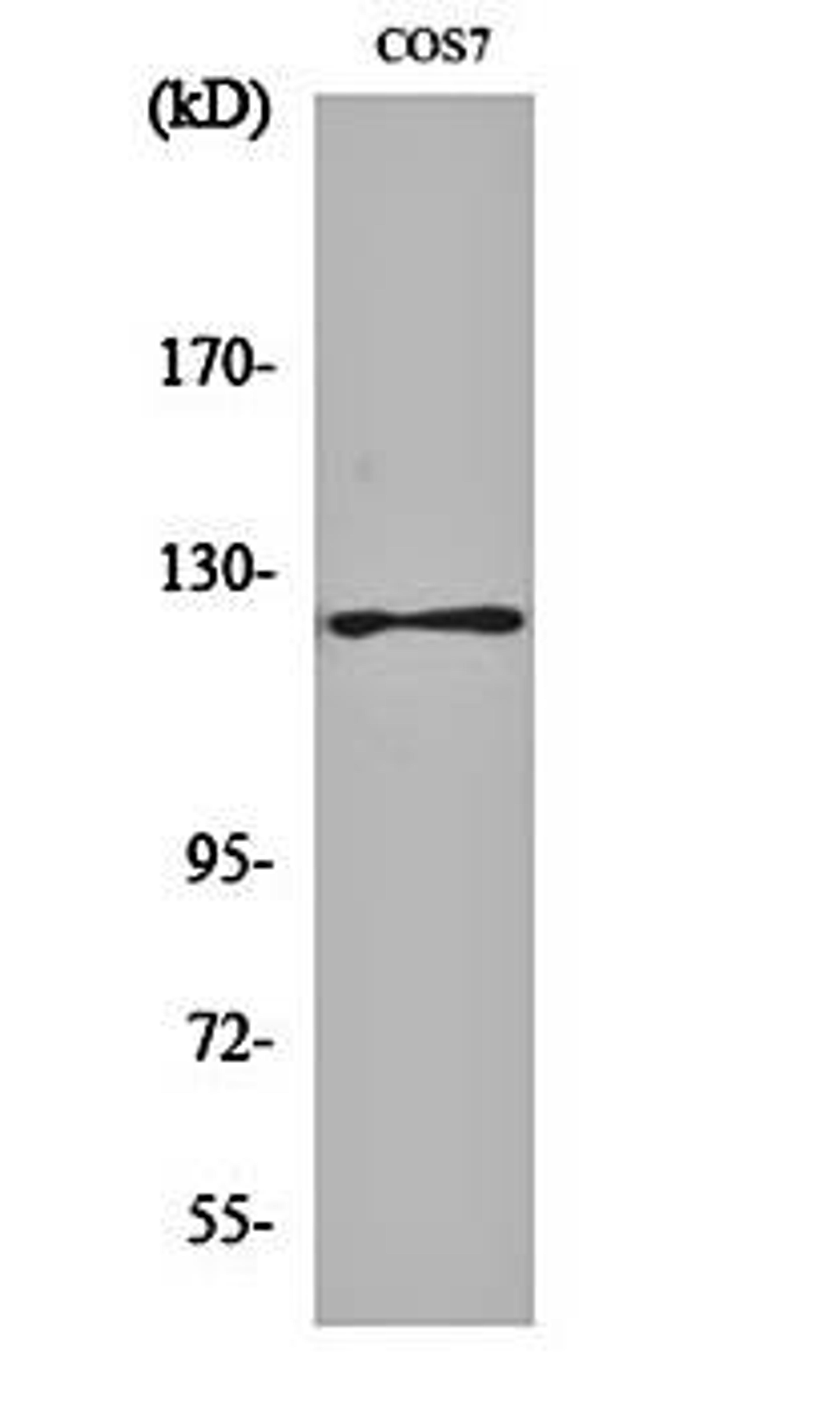 Western blot analysis of COS7 cell lysates using FAK (phospho-Y861) antibody