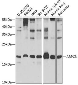 Western blot - ARPC3 Antibody (A7767)
