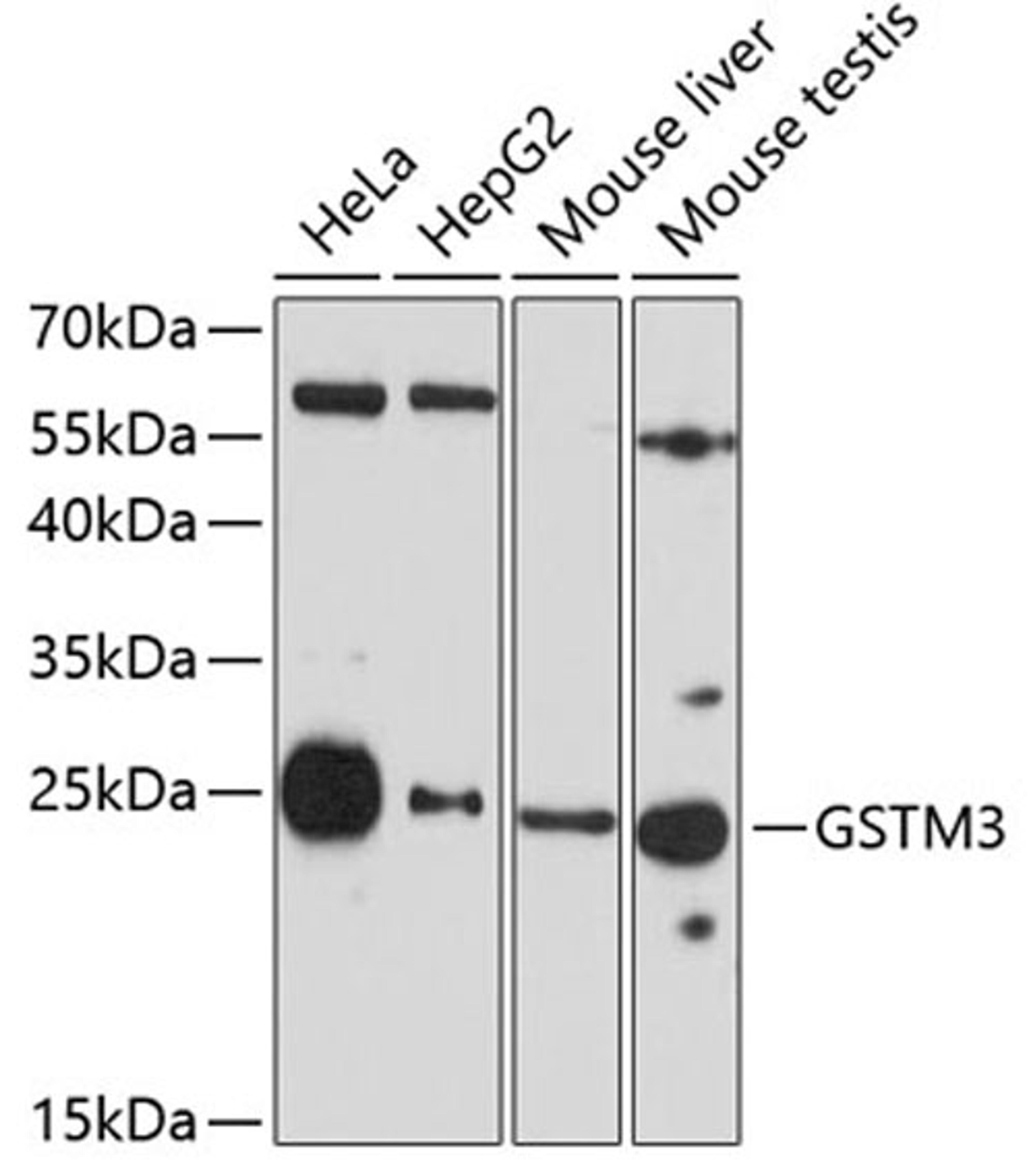 Western blot - GSTM3 antibody (A7679)