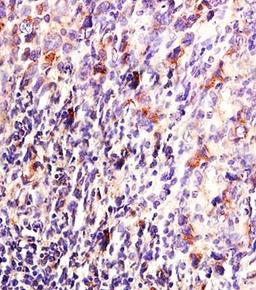 Immunohistochemical analysis of formalin fixed and paraffin embedded mouse lymphoma tissue using MKP-1/DUSP1 antibody